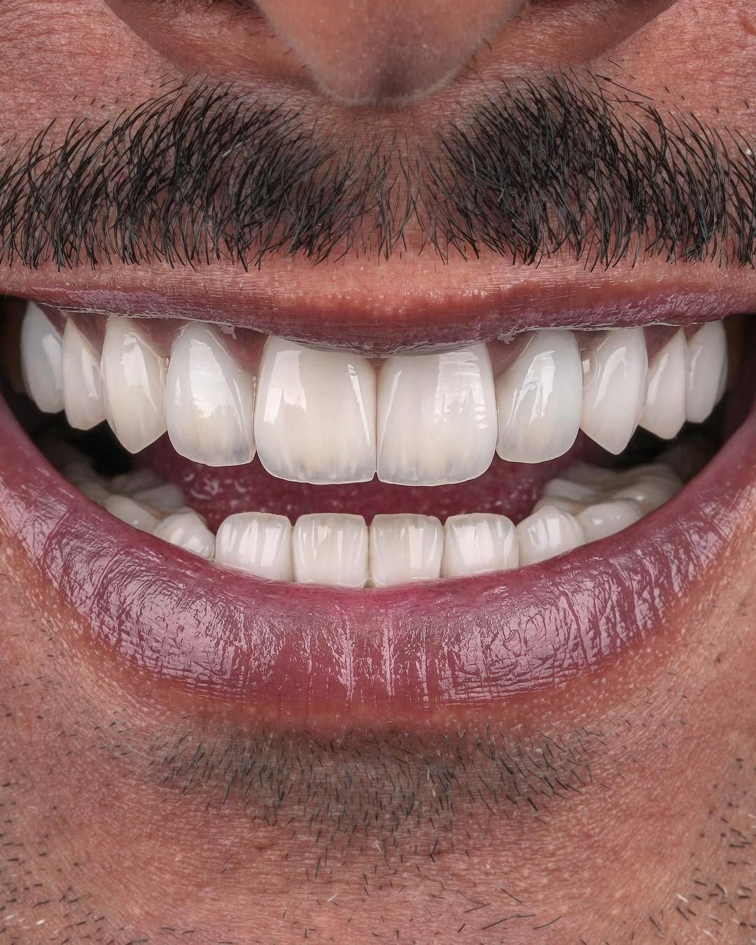 Dental Result 1