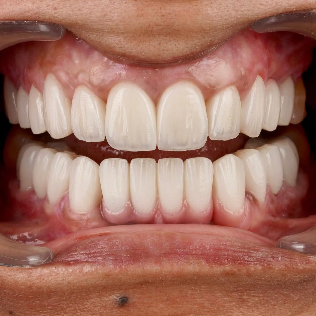 Dental Result 4