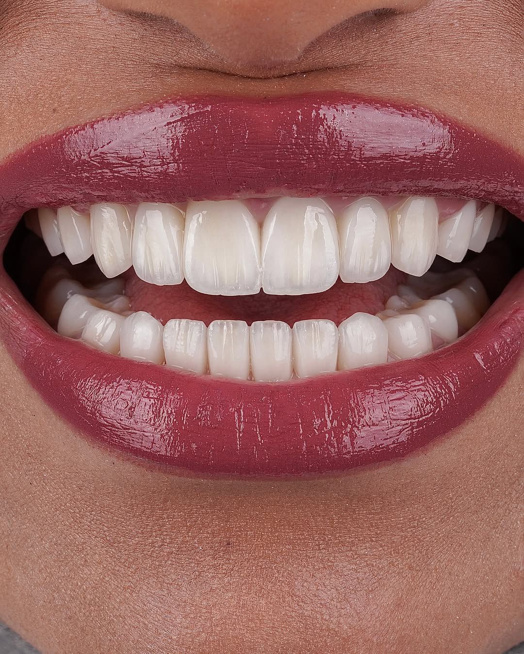 Dental Result 5