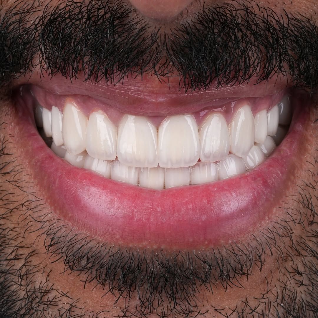 Dental Result 7